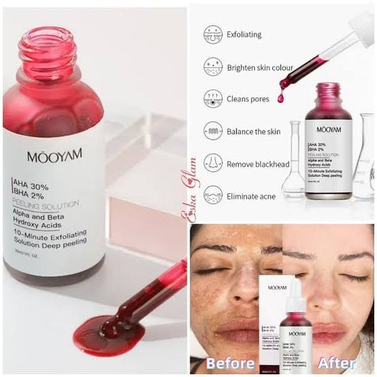 MOOYAM AHA 30% BHA 2% Peeling Solution – 10-Minute Exfoliating Deep Peel