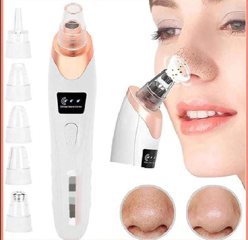 Electric Blackhead Remover Vacuum – 6-in-1 Pore Cleanser & Skin Rejuvenator